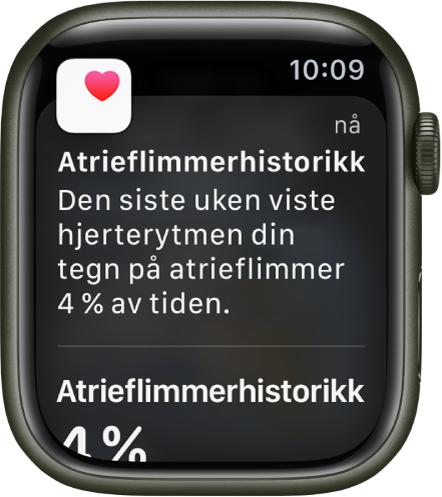 En varsling for atrieflimmerhistorikk på Apple Watch