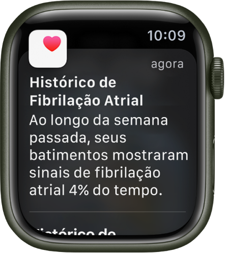 Uma notificação de histórico de fibrilação atrial no Apple Watch.