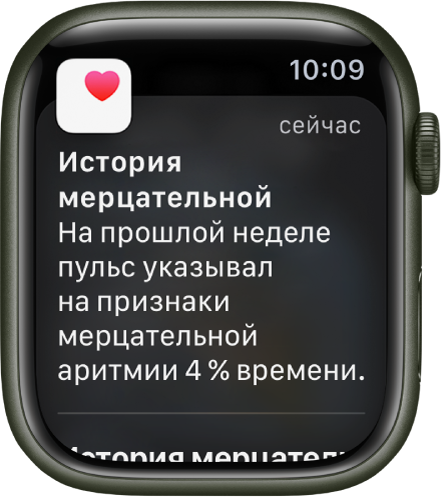 Уведомление об истории мерцательной аритмии показывает, что на прошлой неделе симптомы мерцательной аритмии были 4 % времени.