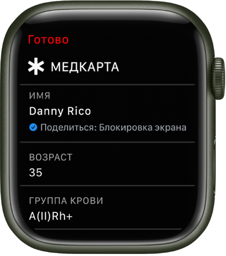 Экран Медкарты на Apple Watch, на котором показаны имя, возраст и группа крови пользователя. Под именем расположен флажок, указывающий, что к Медкарте предоставлен общий доступ на экране блокировки. В левом верхнем углу находится кнопка «Готово».