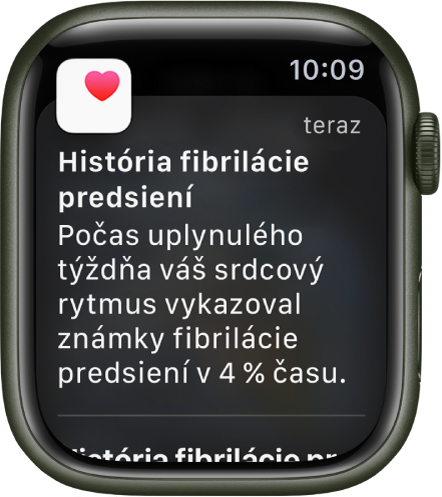 Hlásenie histórie fibrilácie predsiení na hodinkách Apple Watch.
