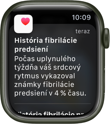 Hlásenie Histórie fibrilácie predsiení s oznámením, že minulý týždeň sa prejavili príznaky fibrilácie predsiení 4 percentá času.