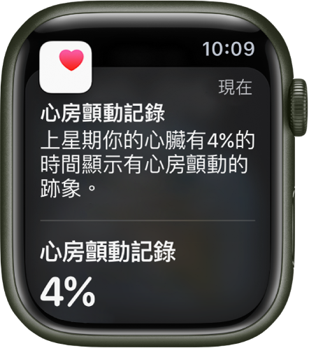 Apple Watch 上的心房顫動記錄通知。