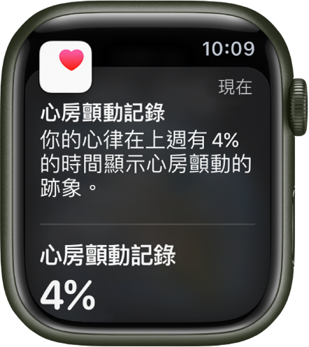 Apple Watch 上的「心房顫動記錄」通知。