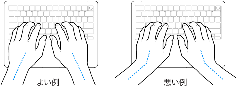 キーボードに置かれた手。手首と手の適切な位置関係と不適切な位置関係を示しています。
