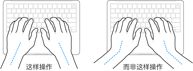 手掌放在键盘上方，显示手腕和手掌的正确对齐位置和错误对齐位置。