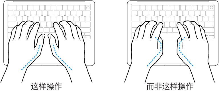 手掌放在键盘上方，显示拇指的正确放置和错误放置。