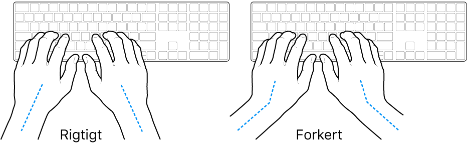 Hænder anbragt over et tastatur med rigtig og forkert position af håndled og hånd.