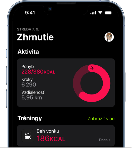 Súhrnná obrazovka v apke Kondícia s časťami Aktivita a Tréningy.