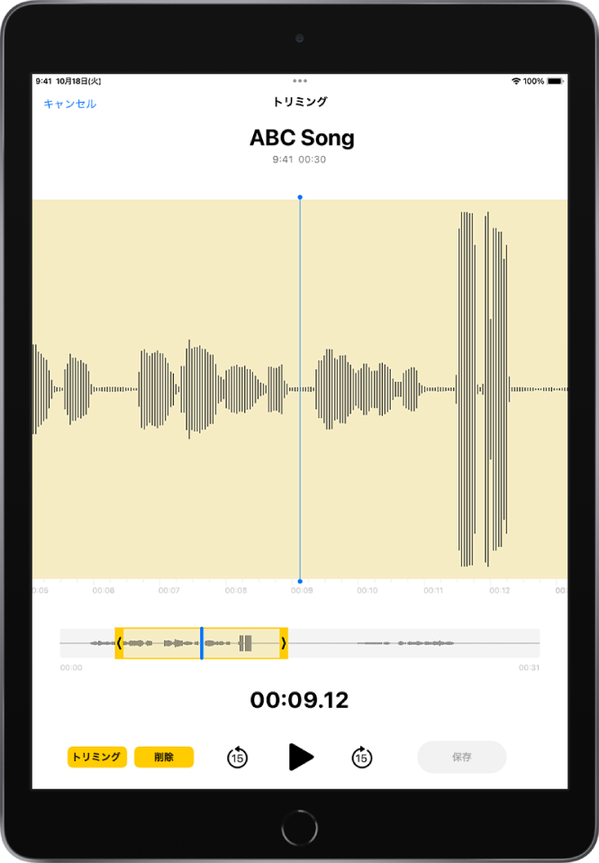 録音のトリミング。画面の下部にあるオーディオ波形の一部が黄色のトリミングハンドルで囲まれています。波形とトリミングハンドルの下には再生ボタンと録音タイマーが表示されています。