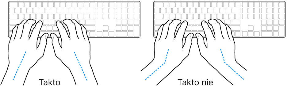Ruky položené na klávesnici znázorňujúce správnu a nesprávnu polohu zápästia a ruky.