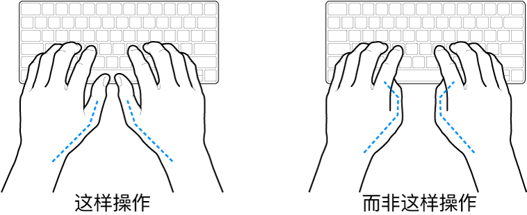 手掌放在键盘上方，显示拇指的正确放置和错误放置。