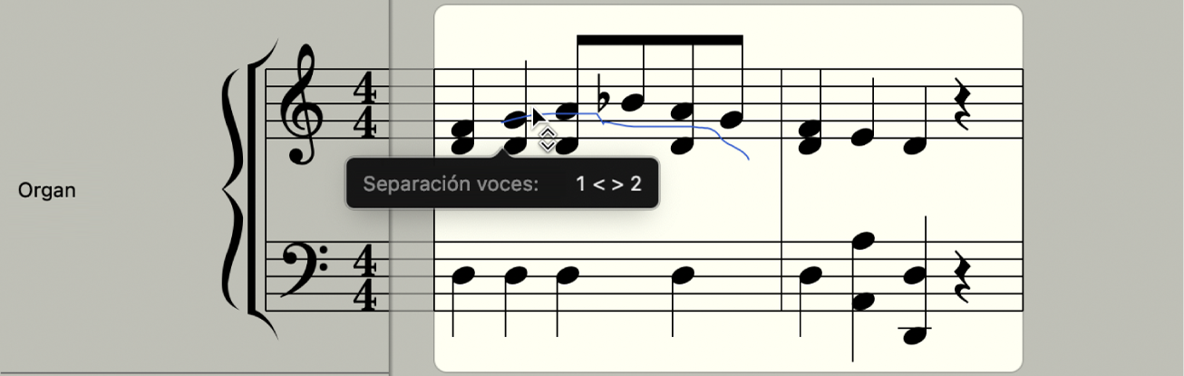 Ilustración. Herramienta “Separación voces” entre dos notas en el editor de partituras.