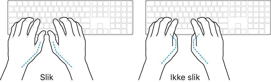 Hender plassert over et tastatur som viser riktig og feil tommelstilling.