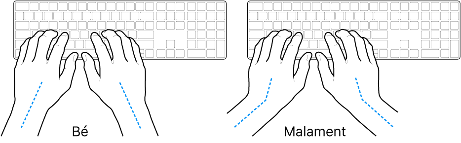 Unes mans posades sobre un teclat mostrant l’alineació correcta i incorrecta del canell i la mà.