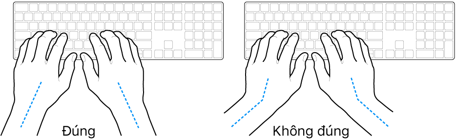 Các bàn tay đặt phía trên bàn phím, minh họa cách đặt cổ tay và bàn tay đúng và sai.