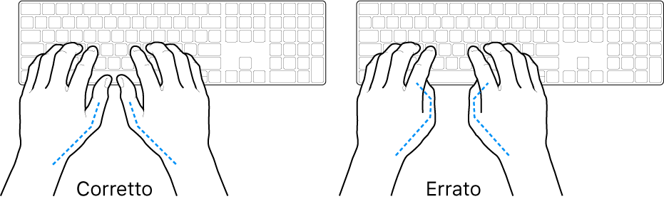 Mani posizionate su una tastiera che illustrano il posizionamento corretto ed errato dei pollici.