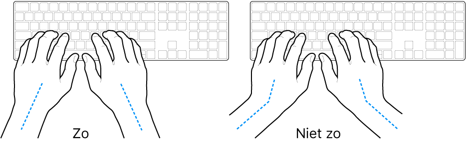Handen boven een toetsenbord, waarbij de goede en verkeerde stand van de handen en polsen wordt aangegeven.