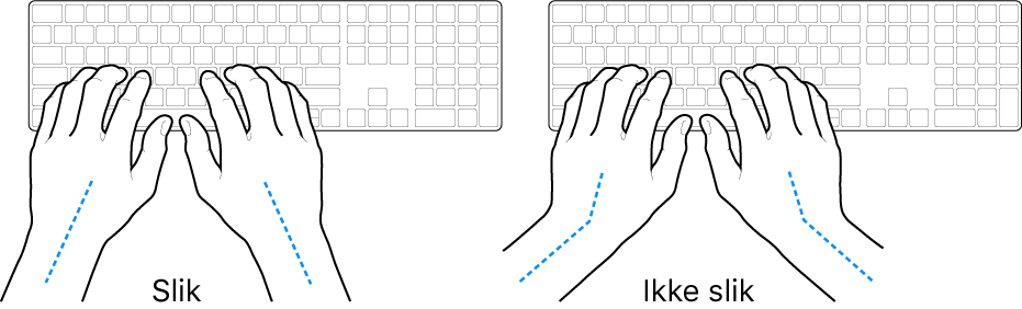 Hender plassert over et tastatur som viser riktig og feil stilling for håndledd og hender.