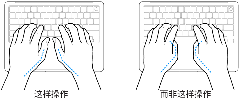 手掌放在键盘上方，显示拇指的正确放置和错误放置。