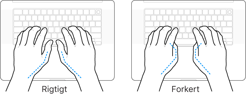 Hænder anbragt over et tastatur med rigtig og forkert position af tommelfingre.