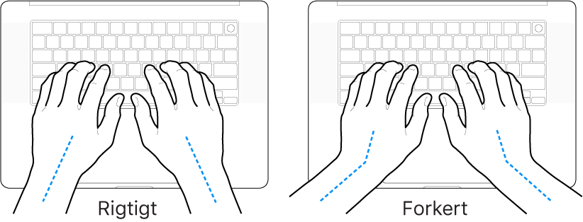 Hænder anbragt over et tastatur med rigtig og forkert position af håndled og hånd.