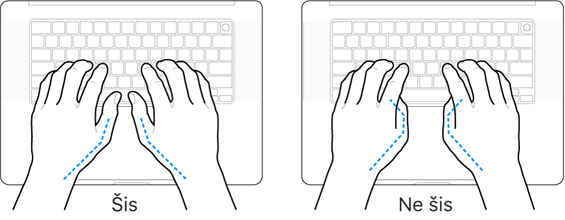 Rokas novietotas virs tastatūras, parādot pareizu un nepareizu īkšķu novietojumu.