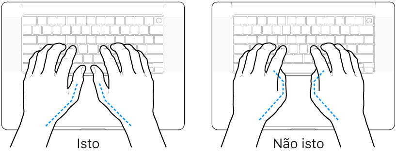 Mãos posicionadas sobre um teclado, mostrando os alinhamentos correto e incorreto dos polegares.