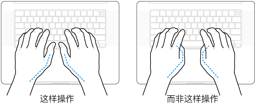 手掌放在键盘上方，显示拇指的正确放置和错误放置。