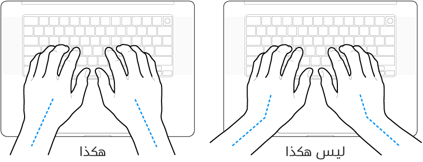 يدان موضوعتان على لوحة مفاتيح، وتظهر المحاذاة الصحيحة وغير الصحيحة للمعصم واليد.