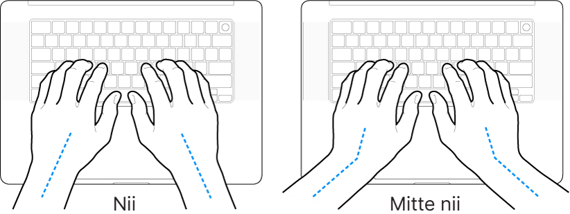 Klaviatuurile paigutatud käed, mis näitavad õiget ja valet randme ja käe joondust.