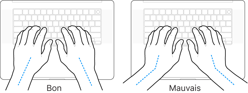 Mains placées sur un clavier, montrant le bon et le mauvais alignement des poignets et des mains.