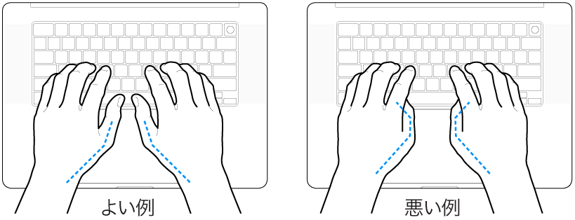 キーボードに置かれた手。親指の適切な位置と不適切な位置を示しています。