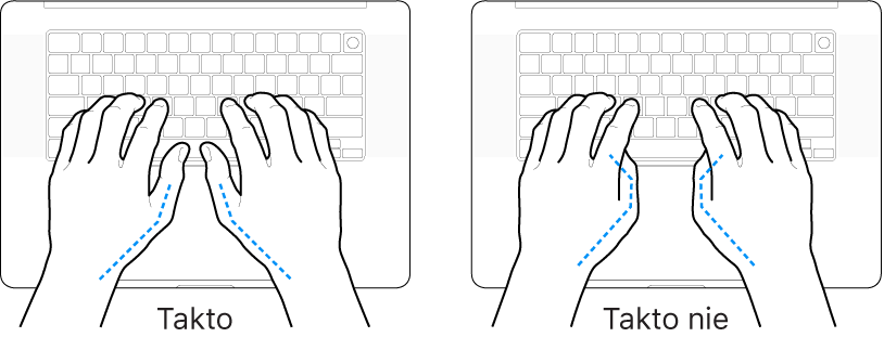 Ruky položené na klávesnici znázorňujúce správnu a nesprávnu polohu palcov.
