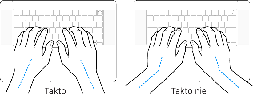 Ruky položené na klávesnici znázorňujúce správnu a nesprávnu polohu zápästia a ruky.