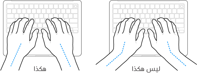 يدان موضوعتان على لوحة مفاتيح، وتظهر المحاذاة الصحيحة وغير الصحيحة للمعصم واليد.