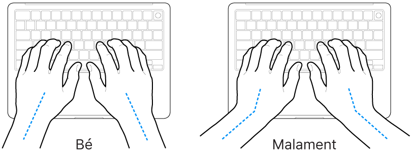 Unes mans posades sobre un teclat mostrant l’alineació correcta i incorrecta del canell i la mà.