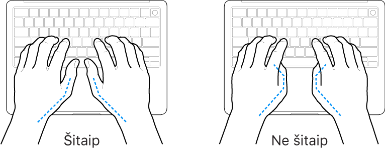 Virš klaviatūros laikomos rankos: rodoma, kaip tinkamai ir netinkamai laikyti nykščius.
