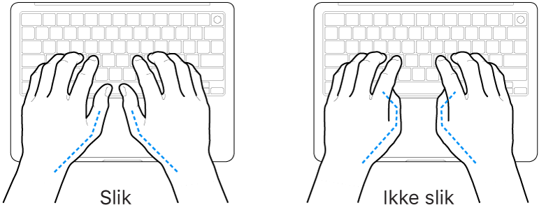 Hender plassert over et tastatur som viser riktig og feil tommelstilling.