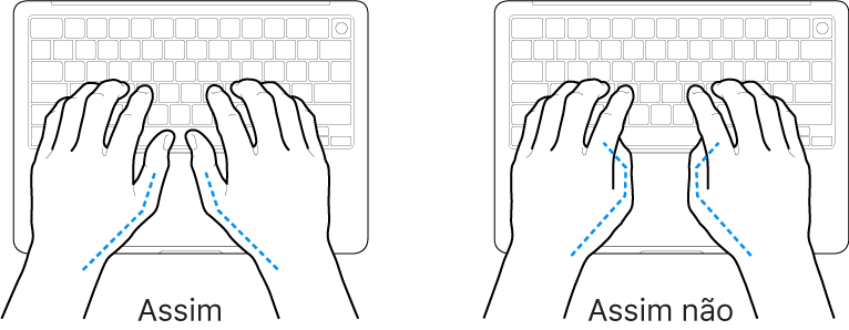 As mãos posicionadas sobre um teclado a mostrar a colocação correta e incorreta dos polegares.