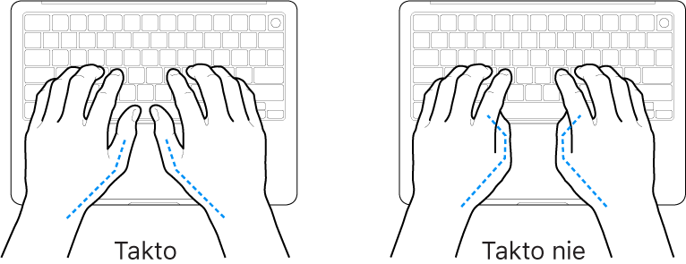 Ruky položené na klávesnici znázorňujúce správnu a nesprávnu polohu palcov.