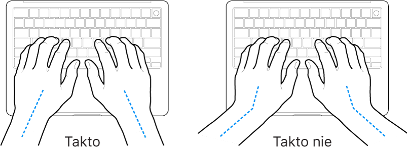 Ruky položené na klávesnici znázorňujúce správnu a nesprávnu polohu zápästia a ruky.
