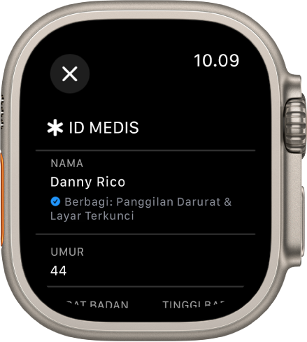 Layar ID Medis di Apple Watch menampilkan nama dan umur pengguna. Tanda centang berada di bawah nama, menunjukkan ID Medis sedang dibagikan di layar terkunci. Tombol Tutup berada di kiri atas.