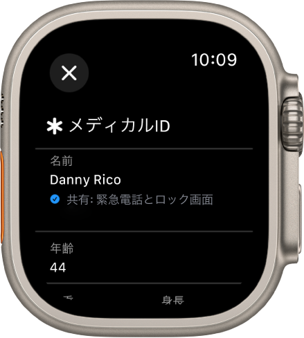 Apple Watchの「メディカルID」画面。ユーザの名前および年齢が表示されています。名前の下にチェックマークがあり、メディカルIDがロック画面でも共有されていることを示しています。左上に「閉じる」ボタンがあります。