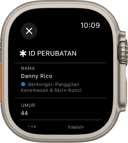 Skrin ID Perubatan pada Apple Watch menunjukkan nama dan umur pengguna. Tanda semak berada di bawah nama, menunjukkan bahawa ID Perubatan dikongsi pada skrin kunci. Butang Tutup berada di bahagian kiri atas.