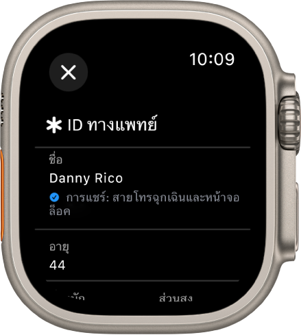 หน้าจอ ID ทางแพทย์บน Apple Watch ที่แสดงชื่อและอายุของผู้ใช้ เครื่องหมายถูกด้านล่างชื่อแสดงว่า ID ทางแพทย์กำลังถูกแชร์อยู่บนหน้าจอล็อค ปุ่มปิดอยู่ที่ด้านซ้ายบนสุด