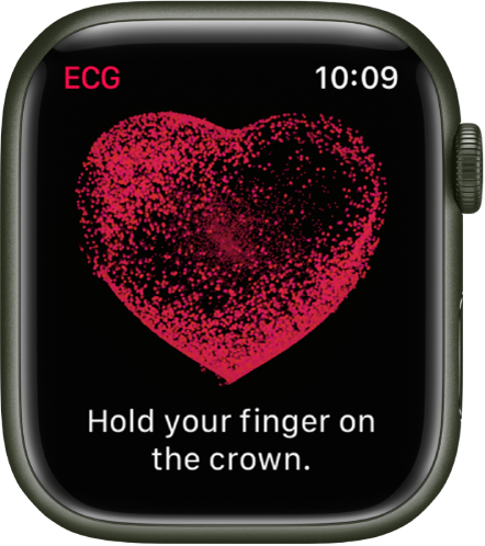 Example of the Apple Watch ECG without abnormalities (a) and from an AF...  | Download Scientific Diagram