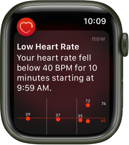 Check your heart rate on Apple Watch - Apple Support (CA)