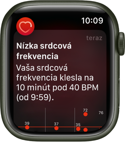 Obrazovka Nízka srdcová frekvencia zobrazujúca hlásenie, že vaša srdcová frekvencia klesla pod 40 BPM po dobu 10 minút.