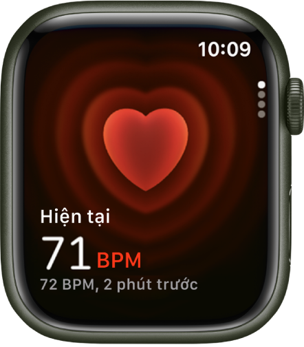 Ảnh Hưởng của Nhịp Tim 72 bpm Đến Sức Khỏe